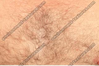 human skin hairy 0015